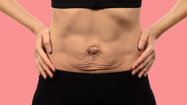 Abdominal Sagging: Seven Ways To Combat From It