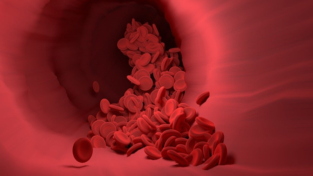 Covid-19 Can Cause Risk Of Stroke: Know How?